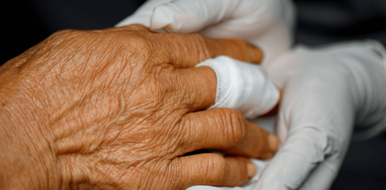 Medizinische Versorgung einer Seniorin – Hand mit Verband